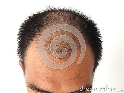 Grabrous. Bald in the middle head. Grabrous is a hereditary trait. Stock Photo