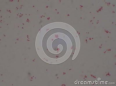 Gram negative diplococi bacteria Neisseria spp Stock Photo