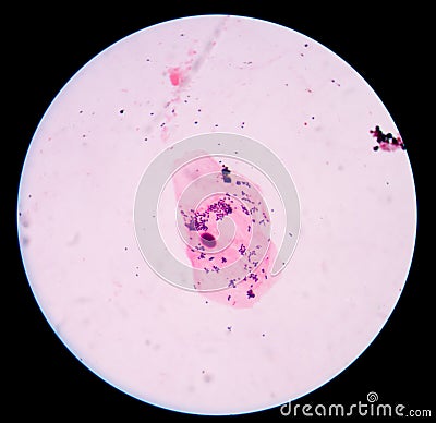 Gram staining, also called Gram's method, is a method of differe Stock Photo