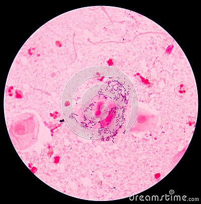 Gram staining, also called Gram's method, is a method of differe Stock Photo