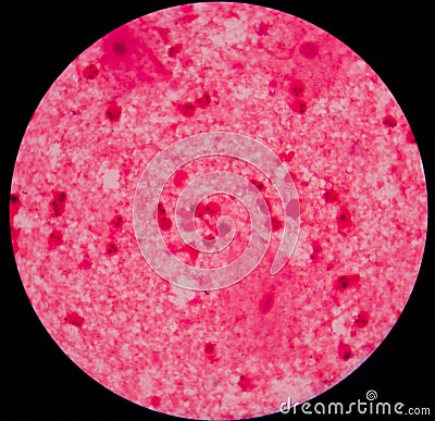 Gram staining, also called Gram's method, is a method of differe Stock Photo