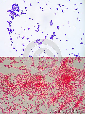 Gram staining Stock Photo