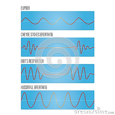 Graph of breathing, the pathological types of breathing Vector Illustration