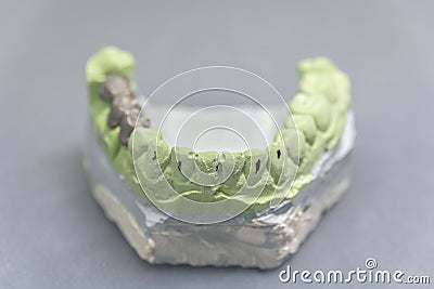 Green dental tooth implant plaster pattern with metal bridge on table Stock Photo