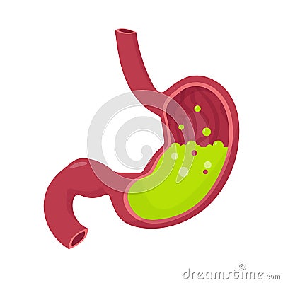 Green liquid inside stomach. Nausea.. Vomiting. Cartoon Illustration