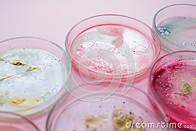 Growth of different bacterial cultures, concept. Bacteriological examination. Harmful and beneficial bacteria, Stock Photo