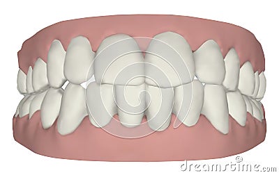 Gums and teeth Stock Photo