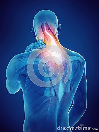 Guy with neck pain Stock Photo