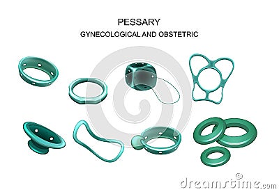 Gynecological and obstetric pessary Vector Illustration