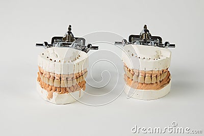 Gypsum Dentures with porcelain teeth isolated on white background Stock Photo