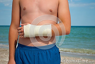 Gypsum fracture on a man`s hand, sand close-up against the background of the sea and the sky clouds, broken arm limb Stock Photo