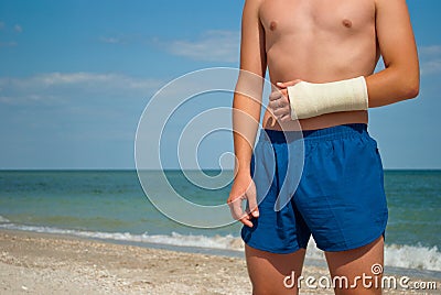 Gypsum fracture on a man`s hand, sand close-up against the background of the sea and the sky clouds, broken arm limb Stock Photo