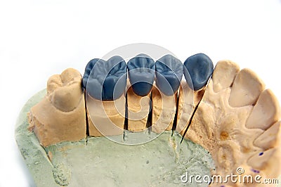 Gypsum model Stock Photo