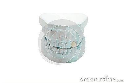 Gypsum model of human teeth Stock Photo