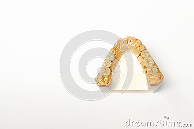 Gypsum model of the teeth of the lower jaw with ceramic teeth. false teeth molars and premolars Stock Photo