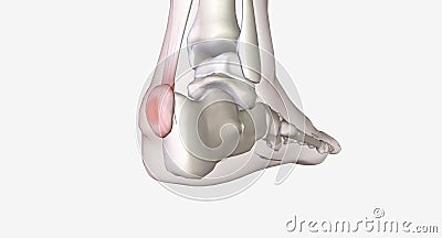 Haglund's deformity is bone growth on the back of the heel Stock Photo