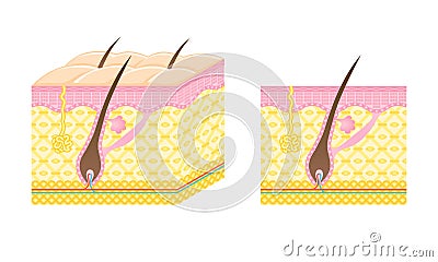 Hair follicle Vector Illustration