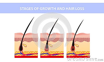 Hair growth phase step by step. Stages of the hair growth cycle. Anagen, telogen, catagen. Anatomy of the skin. Cross section of Vector Illustration