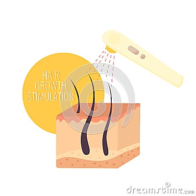 Hair growth stimulation. Red light therapy Vector Illustration