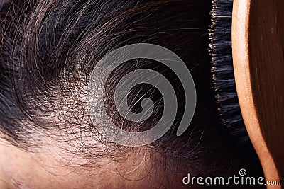 Hair and scalp health problems, Young asian woman with first grey hair Stock Photo