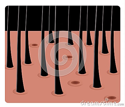 Hair skin Vector Illustration