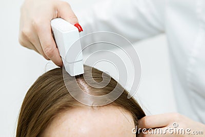 Hair treatment. Fragment of the head with the hair and the hand of the doctor trichologist. Treatment of the hair roots. Close-up Stock Photo