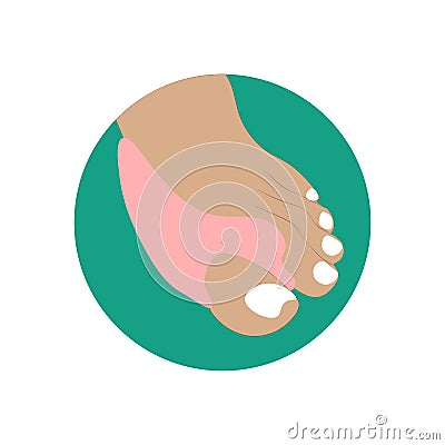 Hallux valgus orthopedic support Vector Illustration