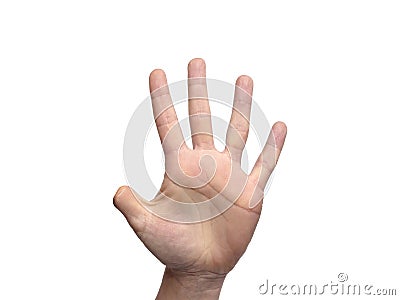 Hand with amputated thumb finger with room for copy Stock Photo