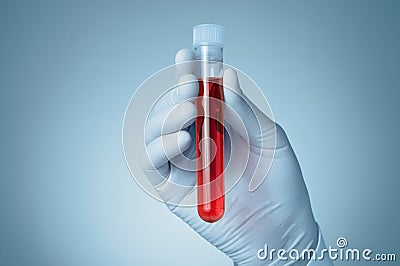 Hand with blood sample Stock Photo