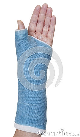 Hand in blue cast on white background Stock Photo