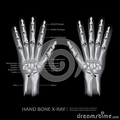 Hand Bone X-Ray Vector Illustration