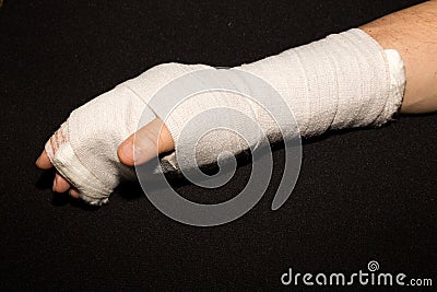 Hand in a cast. Stock Photo