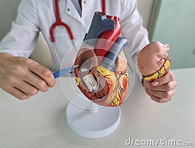 Hand of doctor cardiologist with scalpel anatomy of heart Stock Photo
