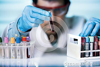 Hand of doctor holding blood sample in tube test for analysis in Stock Photo