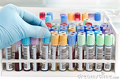 Hand doctor holding a blood tube test with bar code for analysis Stock Photo