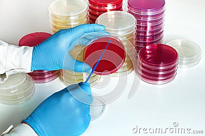 Hand of Doctor making a urine culture in a petri dish Stock Photo