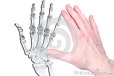 Hand in flash and bone Stock Photo