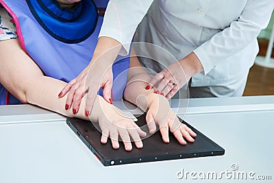 Hand fracture xray diagnosis Stock Photo