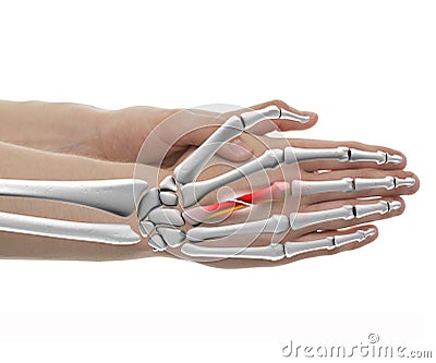 Hand Fractured Bone Male - Studio shot with 3D illustration isolated on white Cartoon Illustration