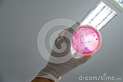 Hand holding an E. coli culture against the light Stock Photo