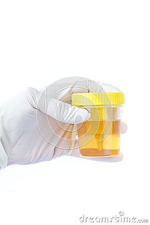 Hand holding a urine sample Stock Photo