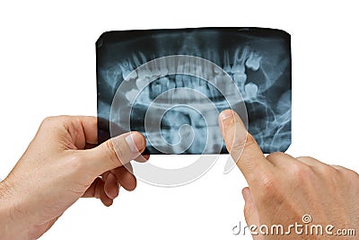 Hand holds radiograph Stock Photo