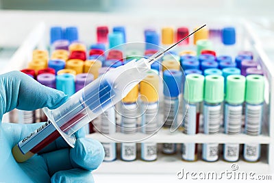 Hand of a lab technician who just collect a blood sample from a Stock Photo