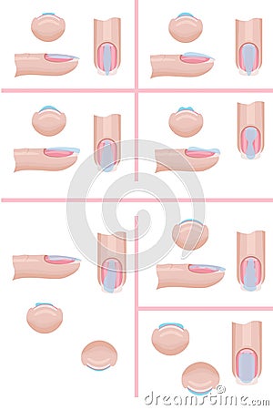 Hand nail care. The technique of applying the base layer of manicure, mistakes. Illustration for the manicure guide. Vector Vector Illustration