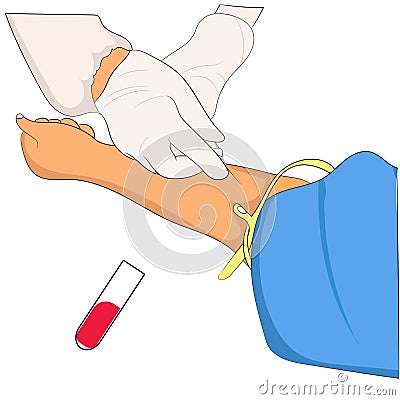 Hand of nurse taking blood fro a vein for testing for hand girl Vector Illustration