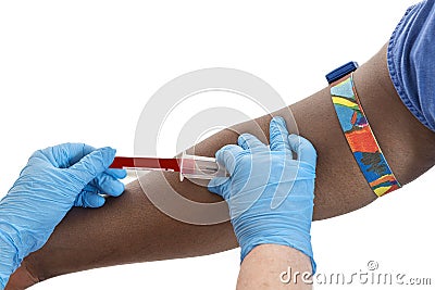 Hand prepare to give a blood for an examination Stock Photo