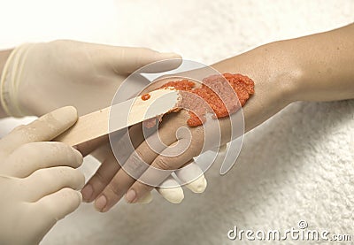Hand procedure Stock Photo