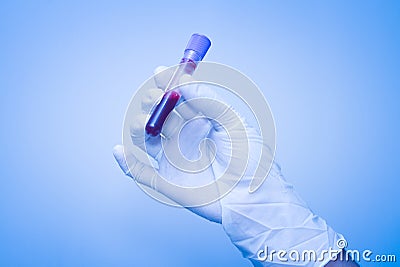 Hand of scientist taking a blood sample tube Stock Photo
