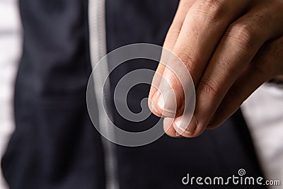 Hand of a man with Asperger syndrome Stock Photo
