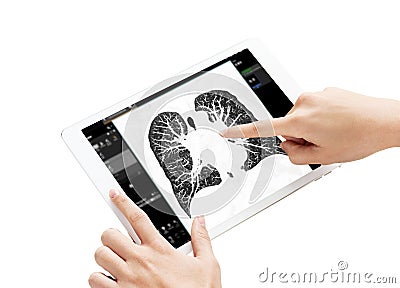 Hand Touching Tablet Display of CT Chest Scan shown on a tablet screen, with a hand pointing to the clear lung structures, Stock Photo
